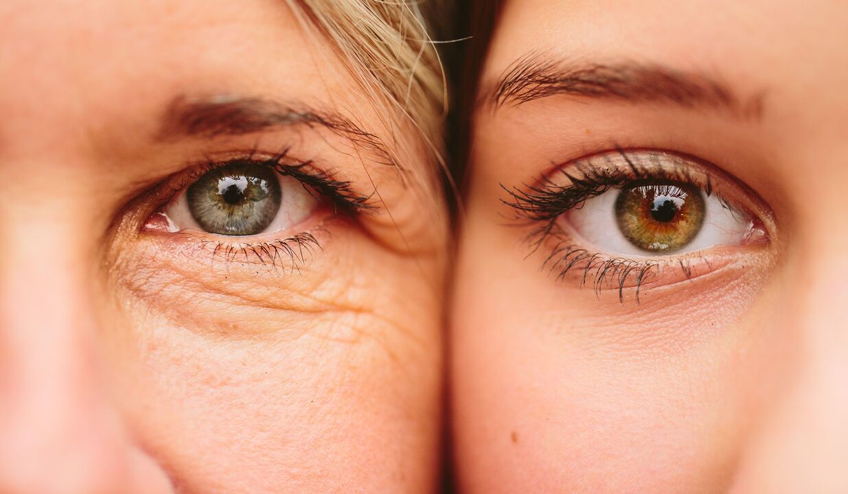 známky stárnutí kolem očí
